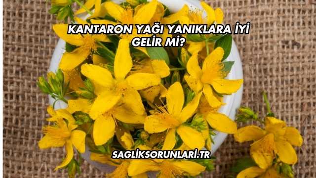Kantaron Yağı Yanıklara İyi Gelir mi?