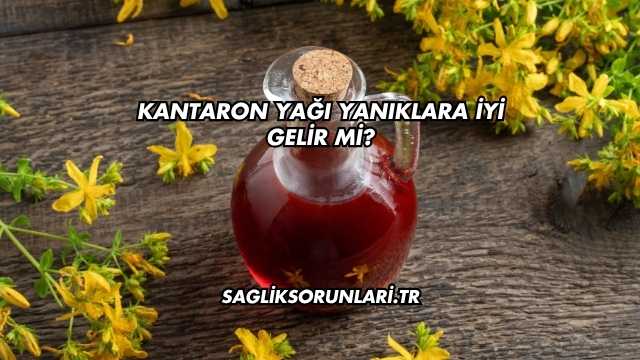 Kantaron Yağı Yanıklara İyi Gelir mi?