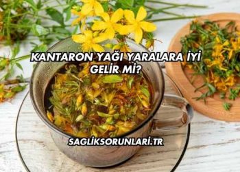 Kantaron Yağı Yaralara İyi Gelir mi?