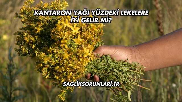Kantaron Yağı Yüzdeki Lekelere İyi Gelir mi?
