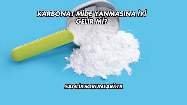Karbonat Mide Yanmasına İyi Gelir mi?