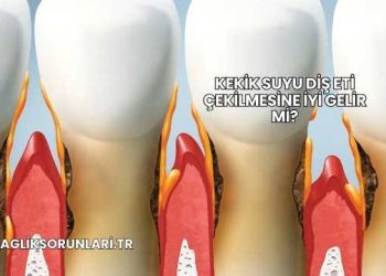 Kekik Suyu Diş Eti Çekilmesine İyi Gelir mi?