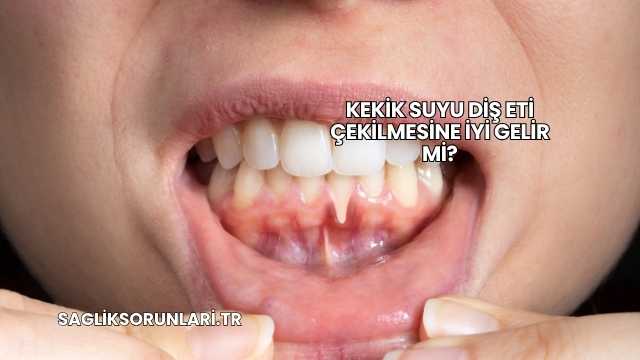Kekik Suyu Diş Eti Çekilmesine İyi Gelir mi?