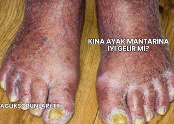 Kına Ayak Mantarına İyi Gelir mi?