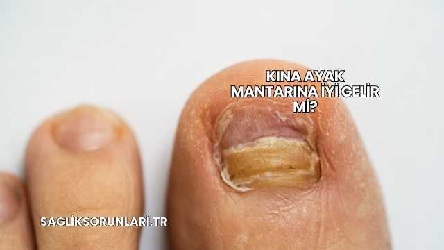 Kına Ayak Mantarına İyi Gelir mi?