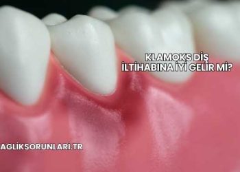 Klamoks Diş İltihabına İyi Gelir mi?