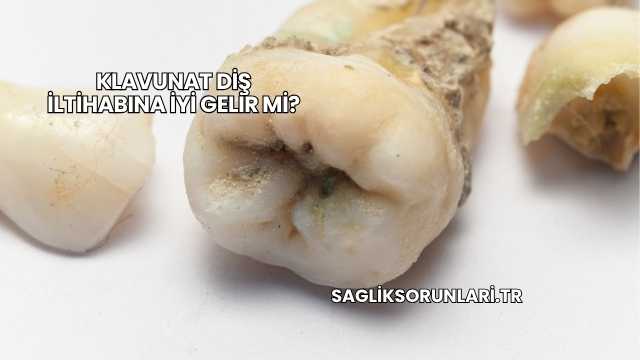 Klavunat Diş İltihabına İyi Gelir mi?