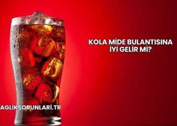 Kola Mide Bulantısına İyi Gelir mi?