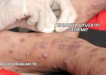 Kolonya Uyuza İyi Gelir mi?