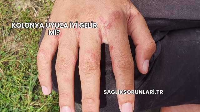 Kolonya Uyuza İyi Gelir mi?