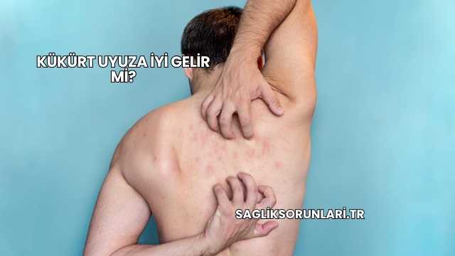 Kükürt Uyuza İyi Gelir mi?