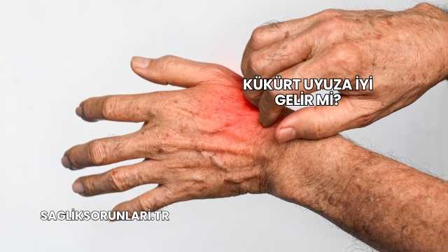 Kükürt Uyuza İyi Gelir mi?