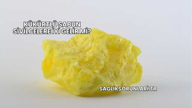 Kükürtlü Sabun Sivilcelere İyi Gelir mi?