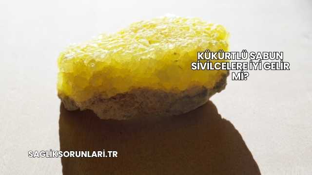 Kükürtlü Sabun Sivilcelere İyi Gelir mi?