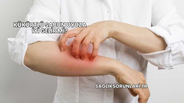 Kükürtlü Sabun Uyuza İyi Gelir mi?