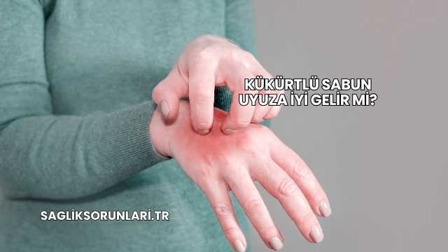 Kükürtlü Sabun Uyuza İyi Gelir mi?