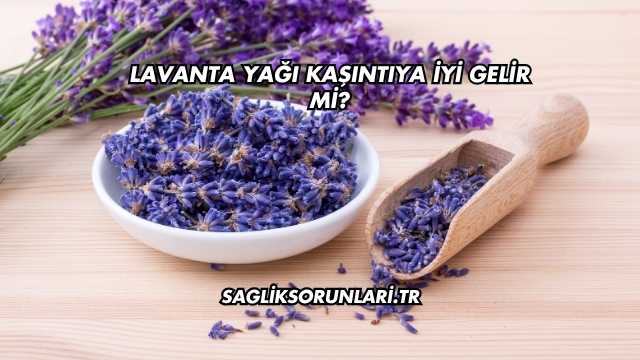 Lavanta Yağı Kaşıntıya İyi Gelir mi?