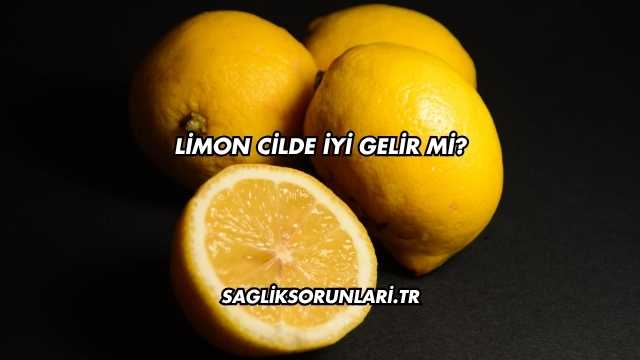 Limon Cilde İyi Gelir mi?