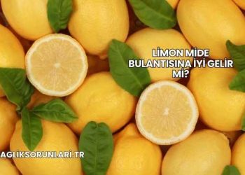 Limon Mide Bulantısına İyi Gelir mi?