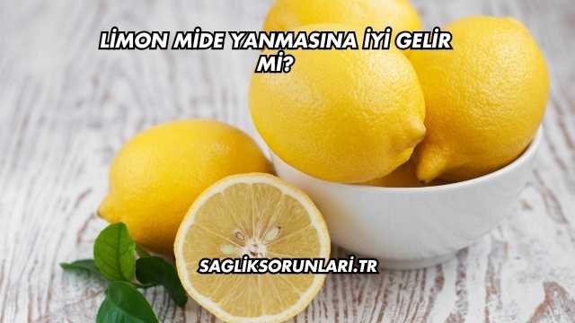 Limon Mide Yanmasına İyi Gelir mi?