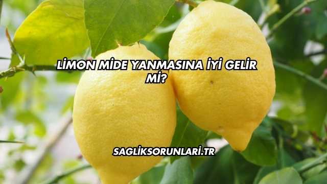 Limon Mide Yanmasına İyi Gelir mi?