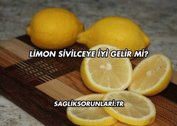 Limon Sivilceye İyi Gelir mi?
