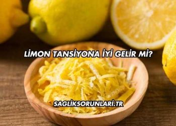 Limon Tansiyona İyi Gelir mi?