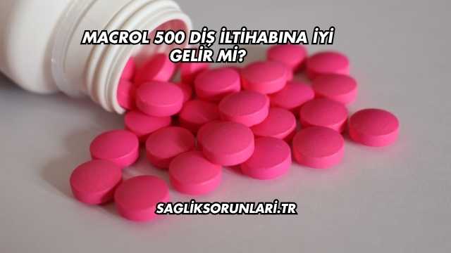 Macrol 500 Diş İltihabına İyi Gelir mi?