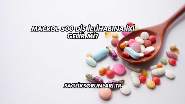 Macrol 500 Diş İltihabına İyi Gelir mi?