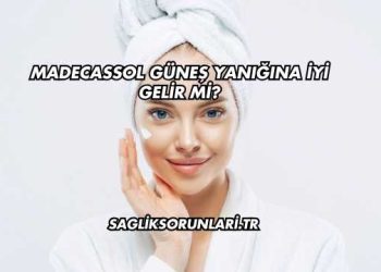 Madecassol Güneş Yanığına İyi Gelir mi?