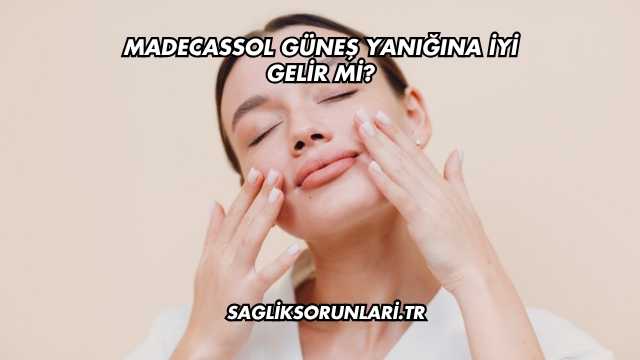 Madecassol Güneş Yanığına İyi Gelir mi?