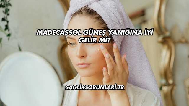 Madecassol Güneş Yanığına İyi Gelir mi?