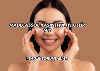 Madecassol Kaşıntıya İyi Gelir mi?