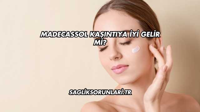 Madecassol Kaşıntıya İyi Gelir mi?