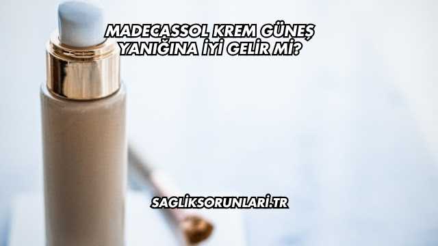 Madecassol Krem Güneş Yanığına İyi Gelir mi?