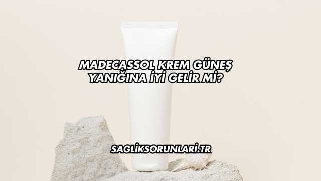 Madecassol Krem Güneş Yanığına İyi Gelir mi?