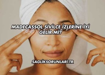 Madecassol Sivilce İzlerine İyi Gelir mi?