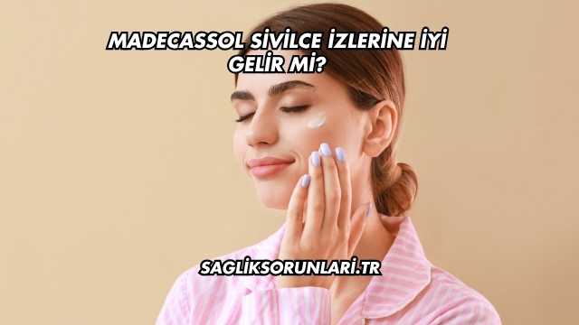 Madecassol Sivilce İzlerine İyi Gelir mi?