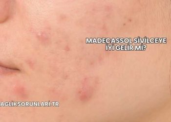 Madecassol Sivilceye İyi Gelir mi?