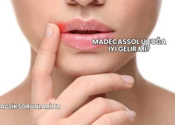Madecassol Uçuğa İyi Gelir mi?