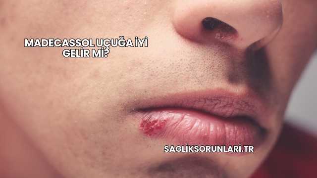 Madecassol Uçuğa İyi Gelir mi?