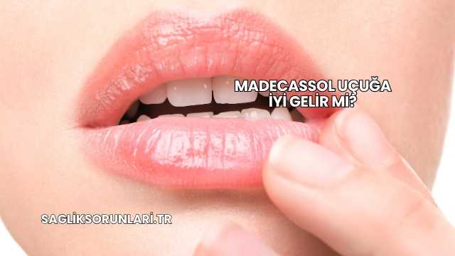 Madecassol Uçuğa İyi Gelir mi?