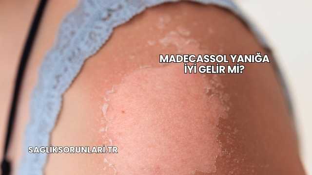 Madecassol Yanığa İyi Gelir mi?