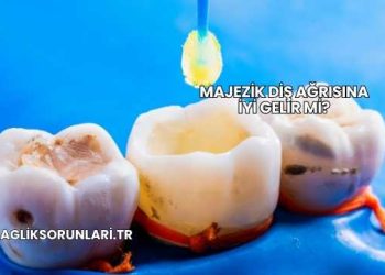 Majezik Diş Ağrısına İyi Gelir mi?