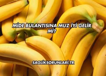 Mide Bulantısına Muz İyi Gelir mi?