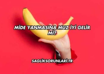 Mide Yanmasına Muz İyi Gelir mi?