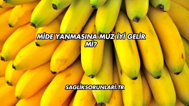 Mide Yanmasına Muz İyi Gelir mi?