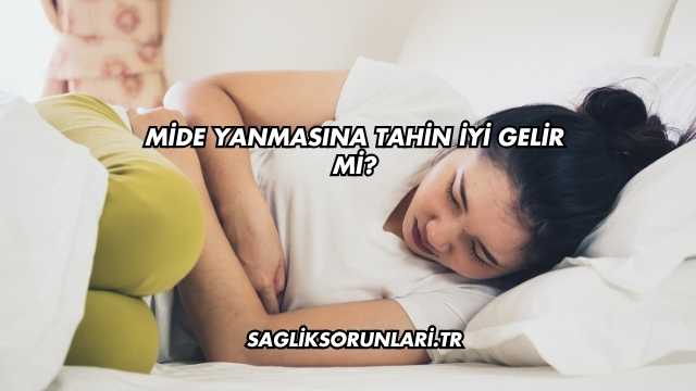 Mide Yanmasına Tahin İyi Gelir mi?