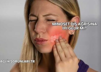 Minoset Diş Ağrısına İyi Gelir mi?