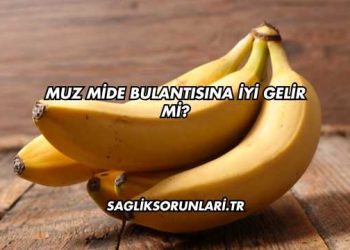 Muz Mide Bulantısına İyi Gelir mi?